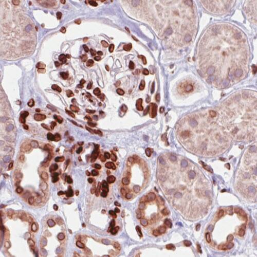 Emerin Antibody (CL0201) - Azide and BSA Free Immunohistochemistry-Paraffin: Emerin Antibody [NBP3-43885]