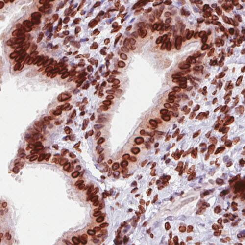 Emerin Antibody (CL0201) - Azide and BSA Free Immunohistochemistry-Paraffin: Emerin Antibody [NBP3-43885]