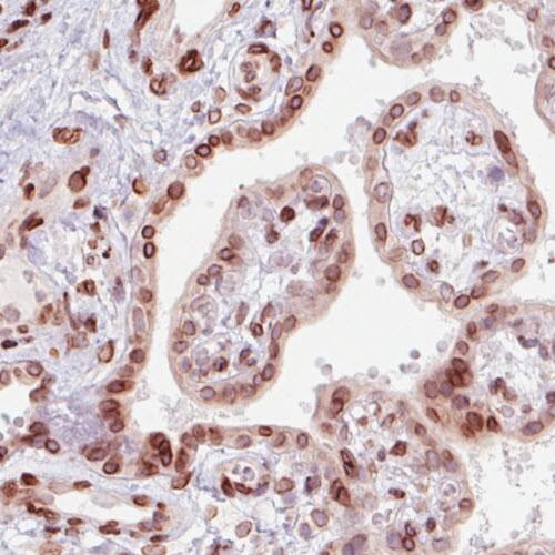 Emerin Antibody (CL0201) - Azide and BSA Free Immunohistochemistry-Paraffin: Emerin Antibody [NBP3-43885]