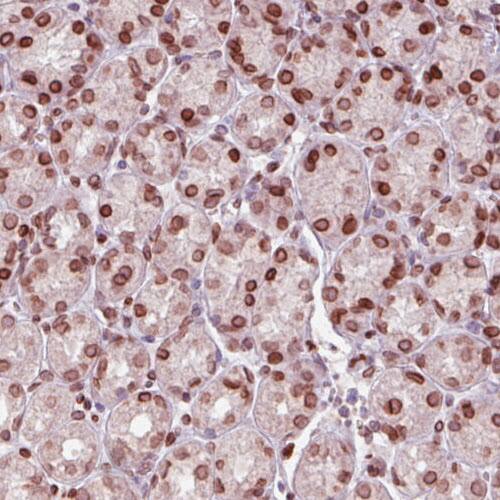 Emerin Antibody (CL0201) - Azide and BSA Free Immunohistochemistry-Paraffin: Emerin Antibody [NBP3-43885]