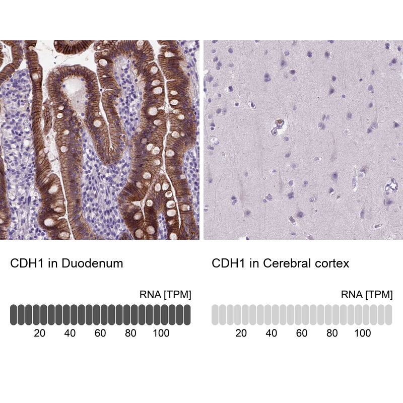 E-Cadherin Antibody (CL1170) - Azide and BSA Free Immunohistochemistry-Paraffin: E-Cadherin Antibody [NBP3-43887]