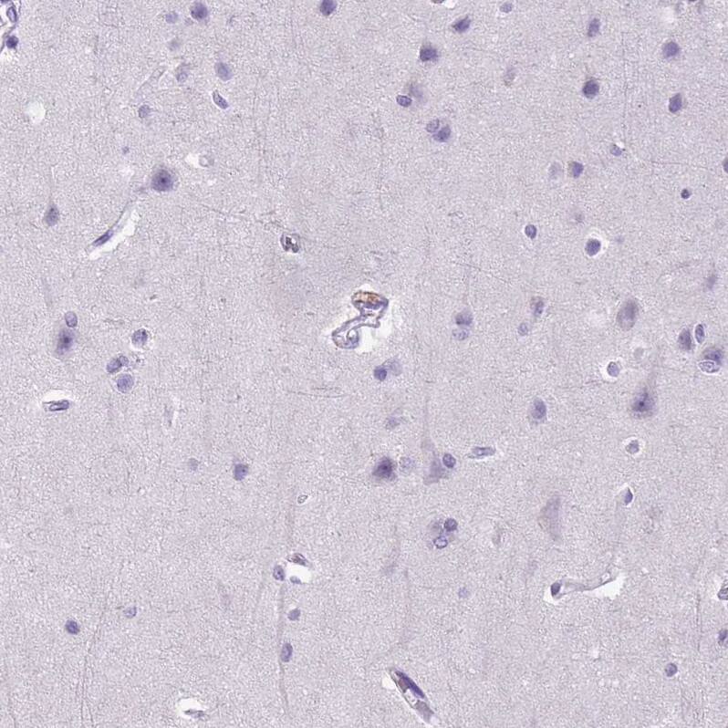 E-Cadherin Antibody (CL1172) - Azide and BSA Free Immunohistochemistry-Paraffin: E-Cadherin Antibody [NBP3-43888]