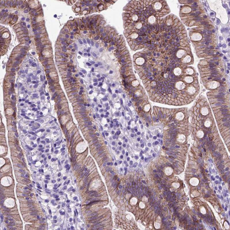 E-Cadherin Antibody (CL1180) - Azide and BSA Free Immunohistochemistry-Paraffin: E-Cadherin Antibody [NBP3-43889]