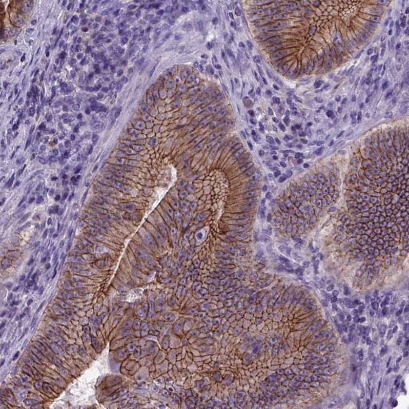 E-Cadherin Antibody (CL1180) - Azide and BSA Free Immunohistochemistry-Paraffin: E-Cadherin Antibody [NBP3-43889]