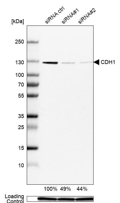 E-Cadherin Antibody (CL1180) - Azide and BSA Free Western Blot: E-Cadherin Antibody [NBP3-43889]