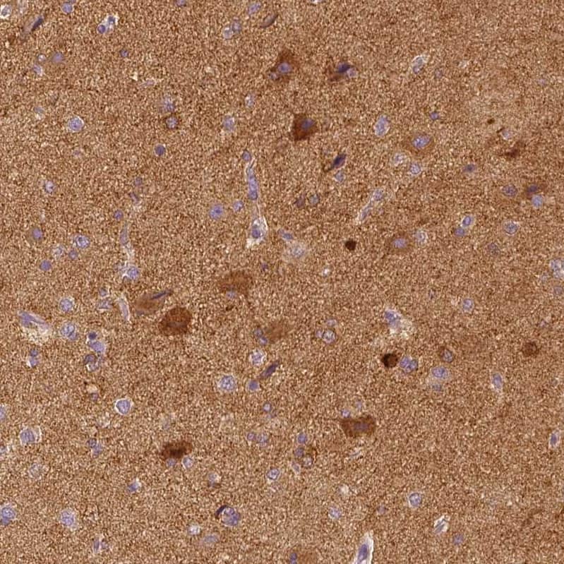 EFCBP2 Antibody (CL0524) - Azide and BSA Free Immunohistochemistry-Paraffin: EFCBP2 Antibody [NBP3-43890]
