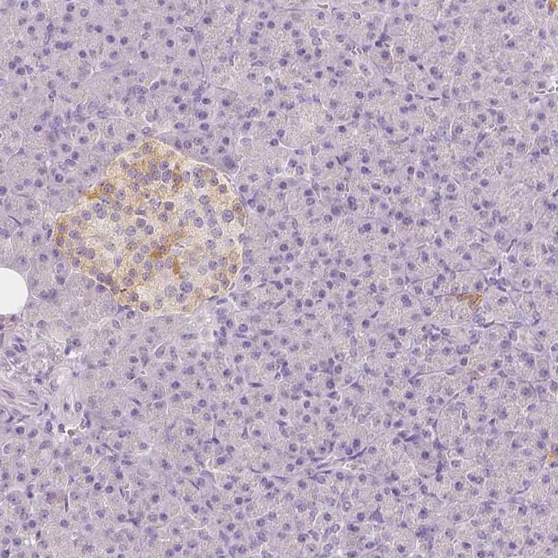 EFCBP2 Antibody (CL0524) - Azide and BSA Free Immunohistochemistry-Paraffin: EFCBP2 Antibody [NBP3-43890]