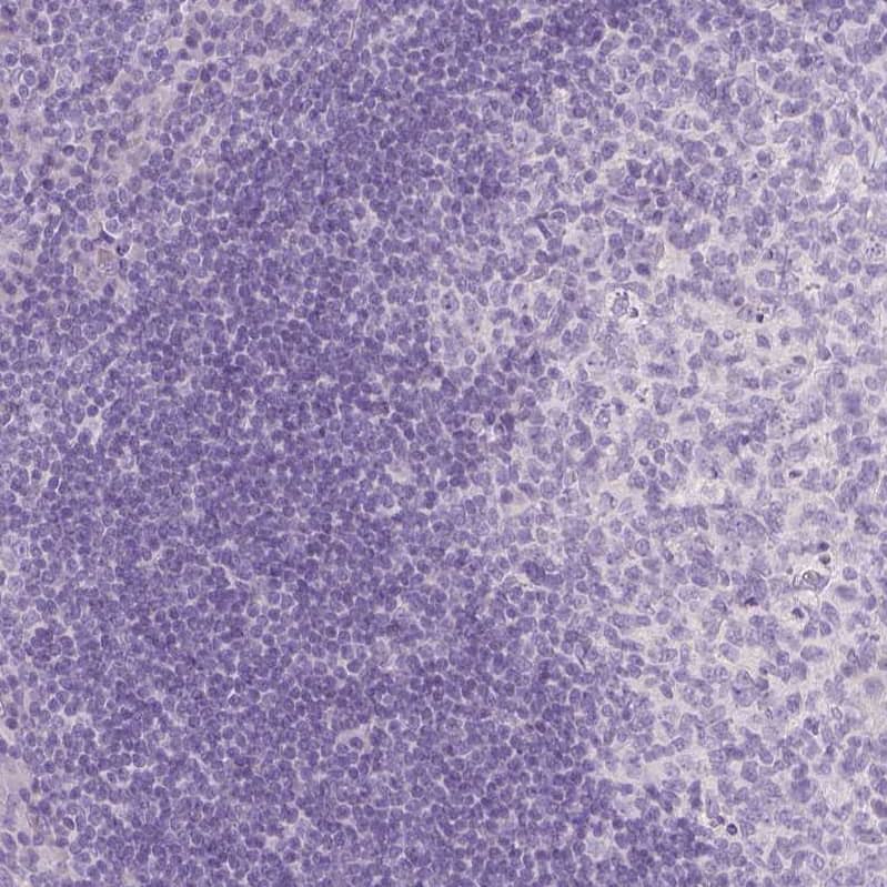 EFCBP2 Antibody (CL0524) - Azide and BSA Free Immunohistochemistry-Paraffin: EFCBP2 Antibody [NBP3-43890]