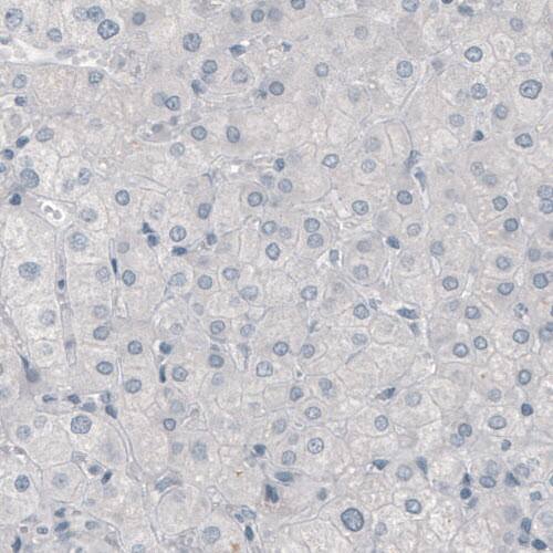 p63/TP73L Antibody (CL3748) - Azide and BSA Free Immunohistochemistry-Paraffin: p63/TP73L Antibody [NBP3-43892]