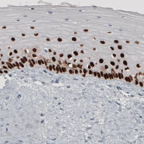 p63/TP73L Antibody (CL3748) - Azide and BSA Free Immunohistochemistry-Paraffin: p63/TP73L Antibody [NBP3-43892]