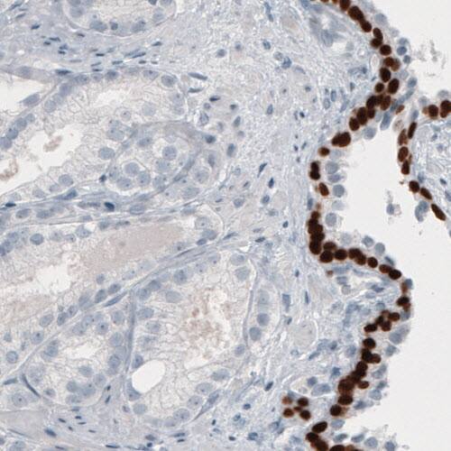 p63/TP73L Antibody (CL3748) - Azide and BSA Free Immunohistochemistry-Paraffin: p63/TP73L Antibody [NBP3-43892]