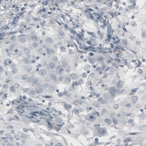 p63/TP73L Antibody (CL3748) - Azide and BSA Free Immunohistochemistry-Paraffin: p63/TP73L Antibody [NBP3-43892]