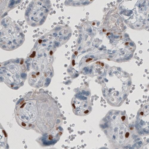 p63/TP73L Antibody (CL3748) - Azide and BSA Free Immunohistochemistry-Paraffin: p63/TP73L Antibody [NBP3-43892]