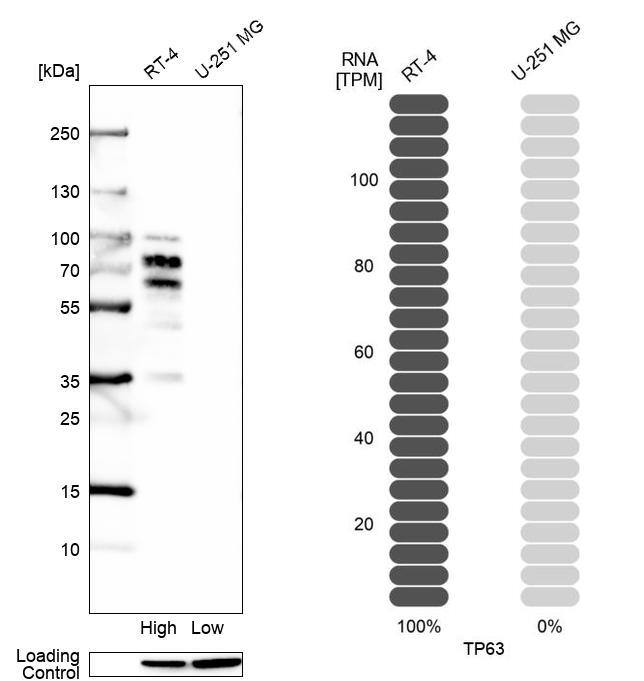 p63/TP73L Antibody (CL3748) - Azide and BSA Free Western Blot: p63/TP73L Antibody [NBP3-43892]