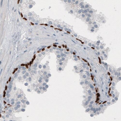 p63/TP73L Antibody (CL3748) - Azide and BSA Free Immunohistochemistry-Paraffin: p63/TP73L Antibody [NBP3-43892]
