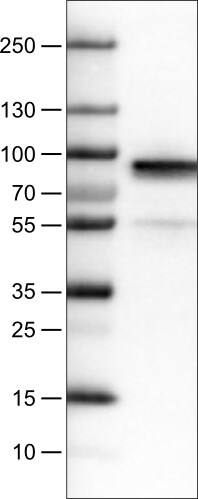 Fibulin 1 Antibody (CL0337) - Azide and BSA Free Western Blot: Fibulin 1 Antibody [NBP3-43893]