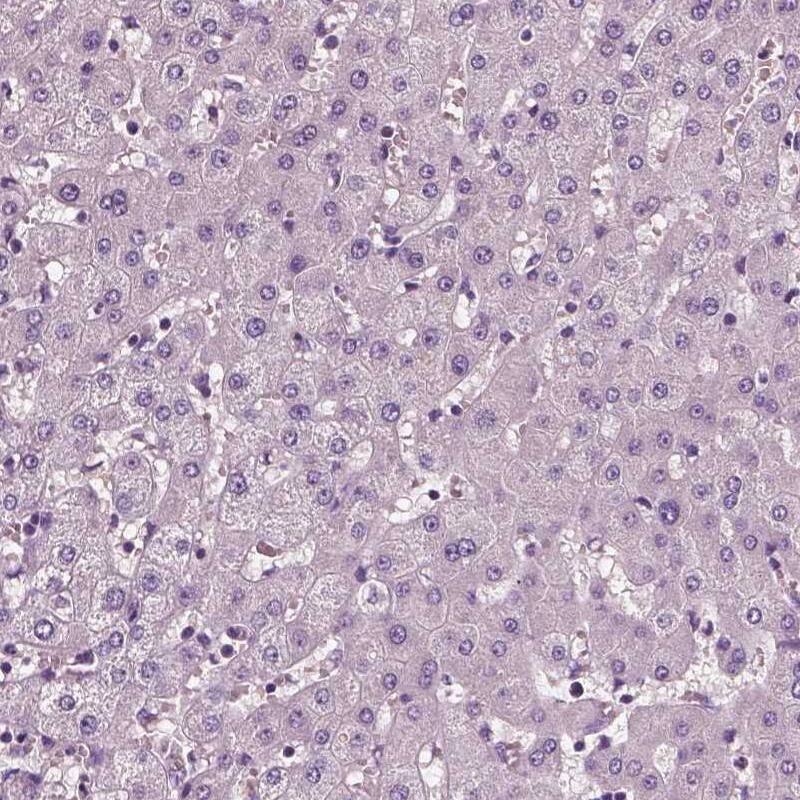 Fibulin 1 Antibody (CL0337) - Azide and BSA Free Immunohistochemistry-Paraffin: Fibulin 1 Antibody [NBP3-43893]