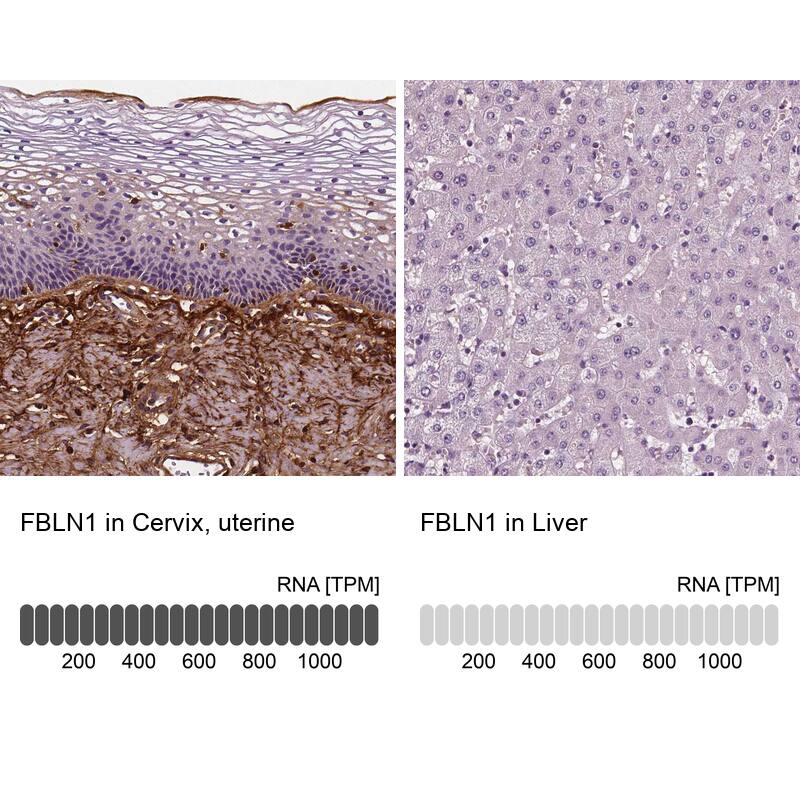Fibulin 1 Antibody (CL0337) - Azide and BSA Free Immunohistochemistry-Paraffin: Fibulin 1 Antibody [NBP3-43893]