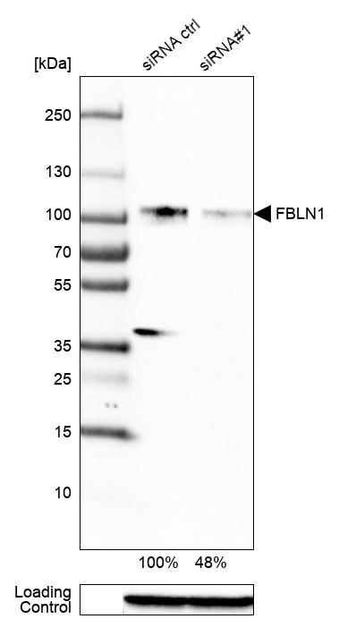 Fibulin 1 Antibody (CL0337) - Azide and BSA Free Western Blot: Fibulin 1 Antibody [NBP3-43893]