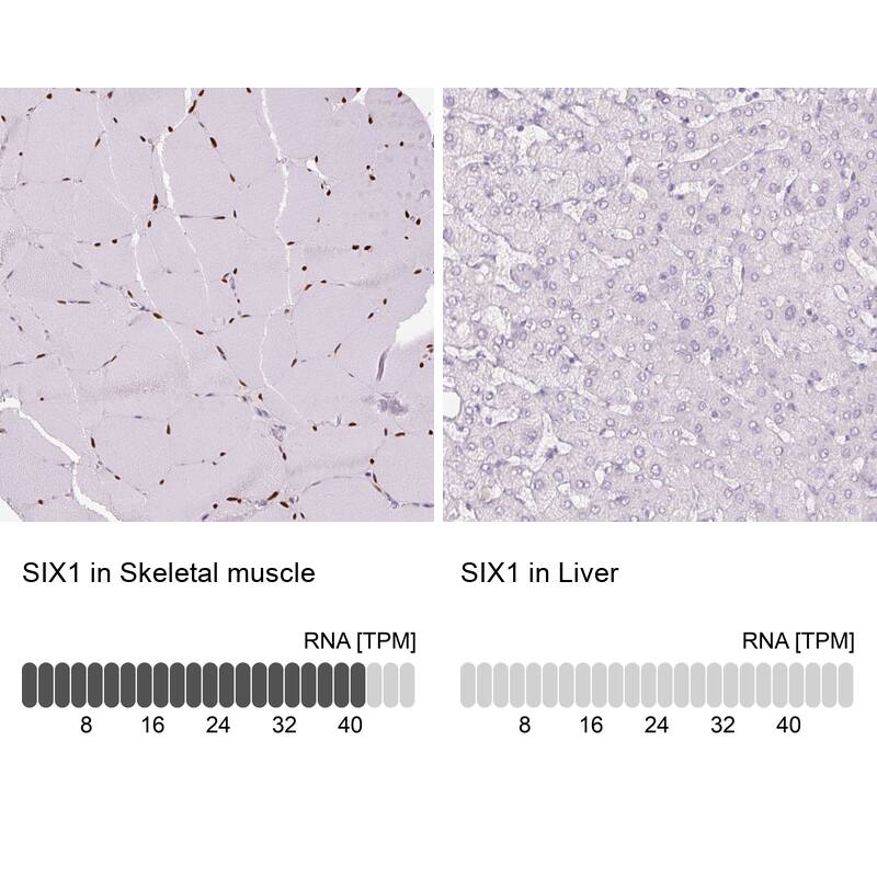 SIX1 Antibody (CL0185) - Azide and BSA Free Immunohistochemistry-Paraffin: SIX1 Antibody [NBP3-43894]
