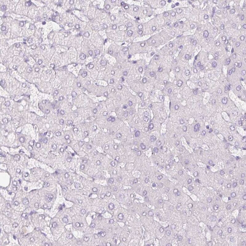 SIX1 Antibody (CL0185) - Azide and BSA Free Immunohistochemistry-Paraffin: SIX1 Antibody [NBP3-43894]