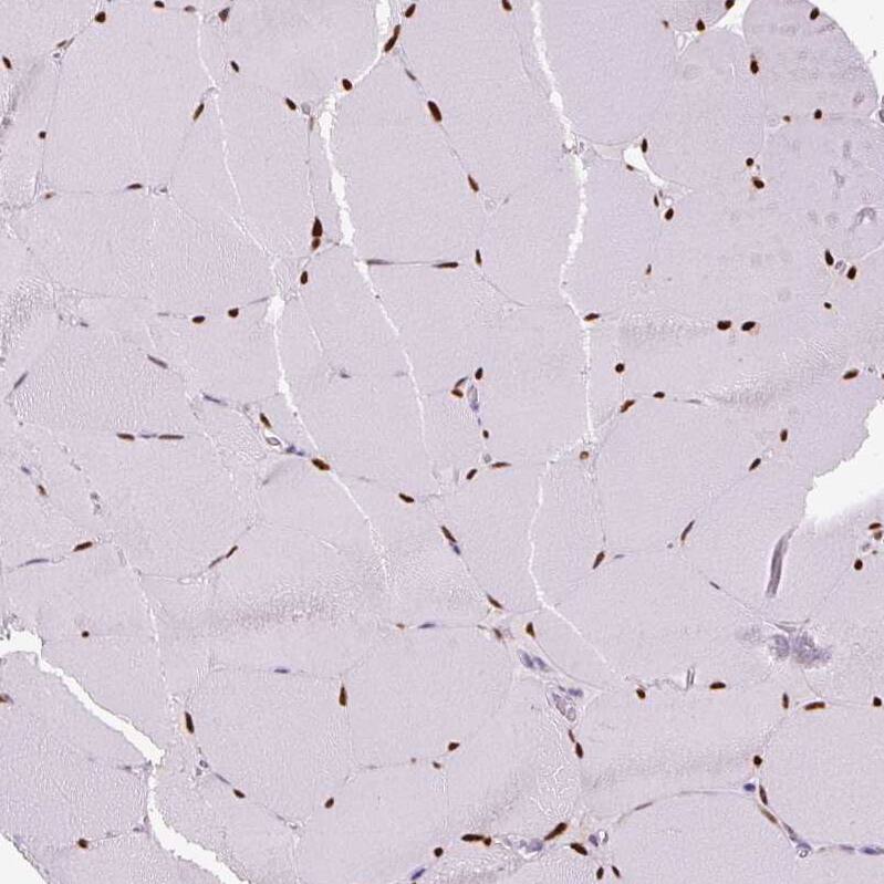 SIX1 Antibody (CL0185) - Azide and BSA Free Immunohistochemistry-Paraffin: SIX1 Antibody [NBP3-43894]