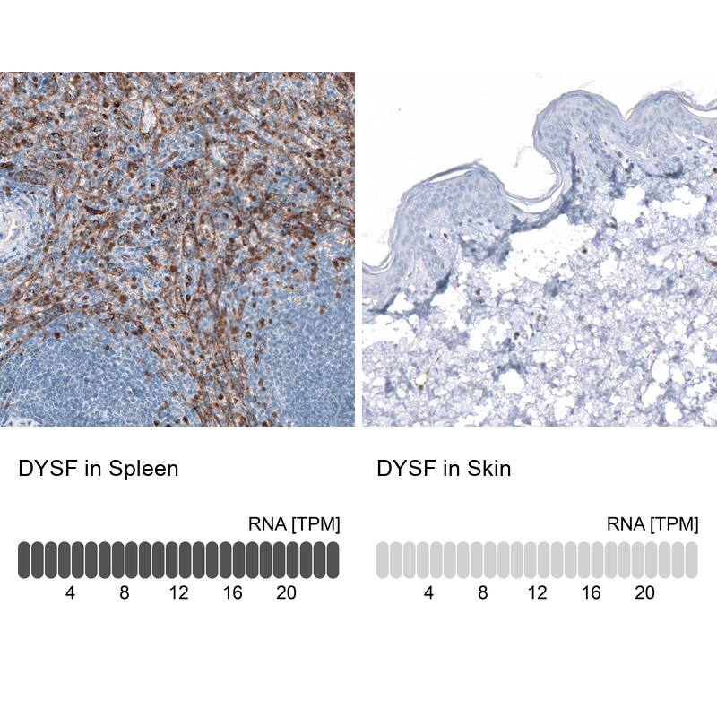 Dysferlin Antibody (CL10888) - Azide and BSA Free Immunohistochemistry-Paraffin: Dysferlin Antibody [NBP3-43895]
