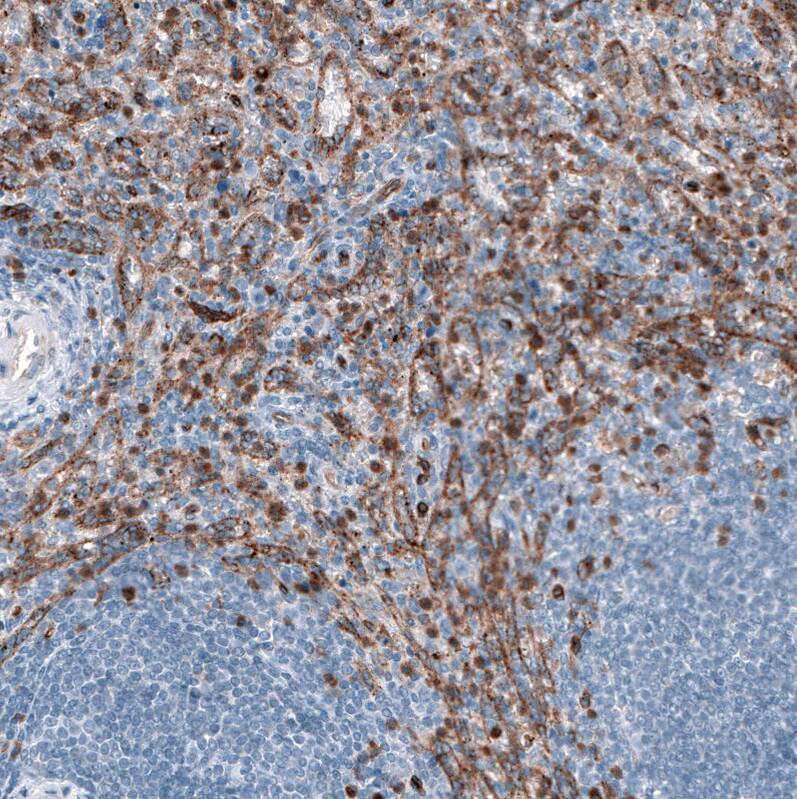 Dysferlin Antibody (CL10888) - Azide and BSA Free Immunohistochemistry-Paraffin: Dysferlin Antibody [NBP3-43895]