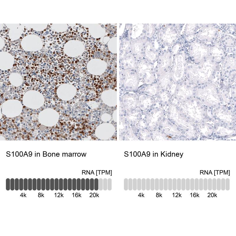S100A9 Antibody (CL11191) - Azide and BSA Free Immunohistochemistry-Paraffin: S100A9 Antibody [NBP3-43896]