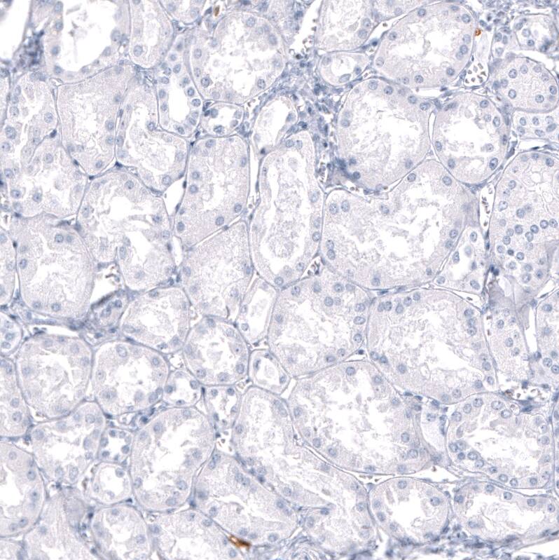 S100A9 Antibody (CL11191) - Azide and BSA Free Immunohistochemistry-Paraffin: S100A9 Antibody [NBP3-43896]