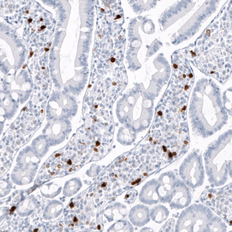 S100A9 Antibody (CL11191) - Azide and BSA Free Immunohistochemistry-Paraffin: S100A9 Antibody [NBP3-43896]