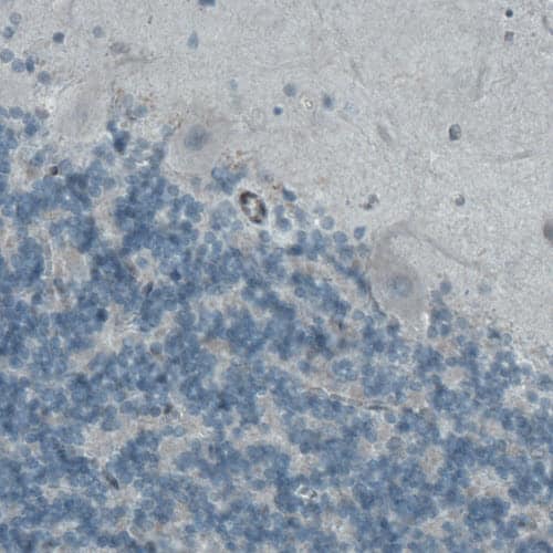 Mcl-1 Antibody (CL1128) - Azide and BSA Free Immunohistochemistry-Paraffin: Mcl-1 Antibody [NBP3-43898]