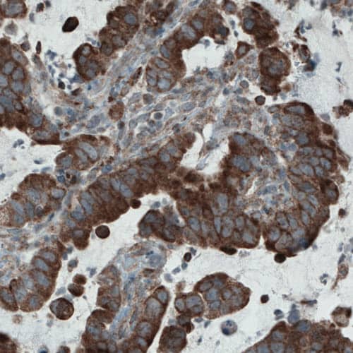 Mcl-1 Antibody (CL1128) - Azide and BSA Free Immunohistochemistry-Paraffin: Mcl-1 Antibody [NBP3-43898]