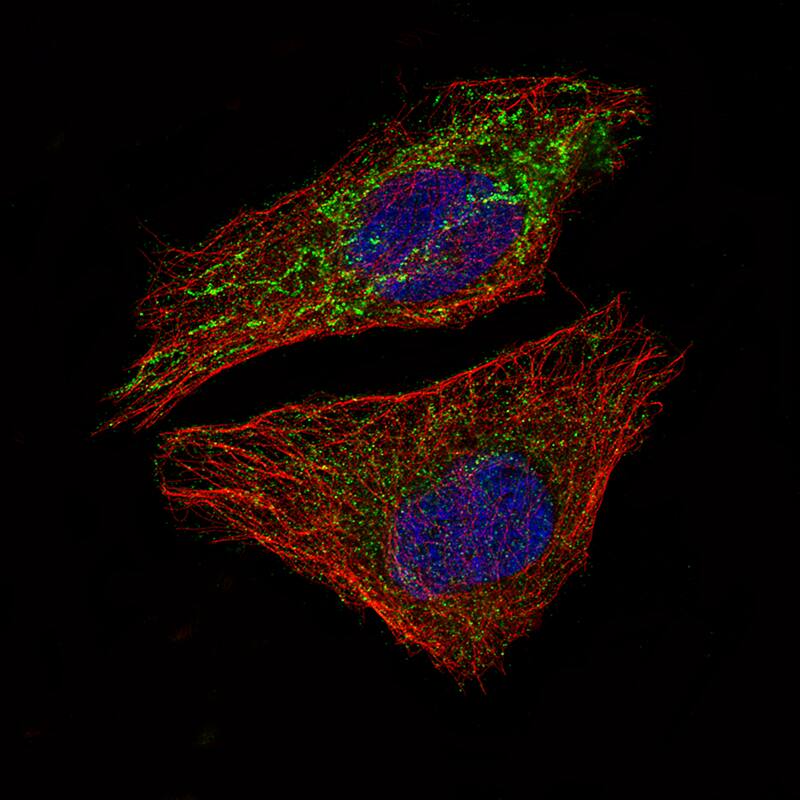 Mcl-1 Antibody (CL1128) - Azide and BSA Free Immunocytochemistry/ Immunofluorescence: Mcl-1 Antibody [NBP3-43898]