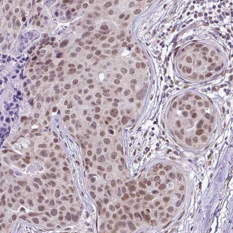 RBM3 Antibody (CL0296) - Azide and BSA Free Immunohistochemistry-Paraffin: RBM3 Antibody [NBP3-43899]