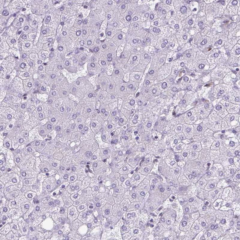 RBM3 Antibody (CL0296) - Azide and BSA Free Immunohistochemistry-Paraffin: RBM3 Antibody [NBP3-43899]