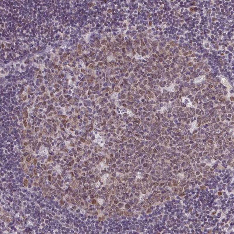 RBM3 Antibody (CL0296) - Azide and BSA Free Immunohistochemistry-Paraffin: RBM3 Antibody [NBP3-43899]