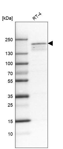 Lysine (K)-specific Demethylase 5B/KDM5B/JARID1B Antibody (CL1147) - Azide and BSA Free Western Blot: Lysine (K)-specific Demethylase 5B/KDM5B/JARID1B Antibody [NBP3-43900]