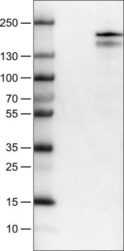 Lysine (K)-specific Demethylase 5B/KDM5B/JARID1B Antibody (CL1129) - Azide and BSA Free Western Blot: Lysine (K)-specific Demethylase 5B/KDM5B/JARID1B Antibody [NBP3-43901]