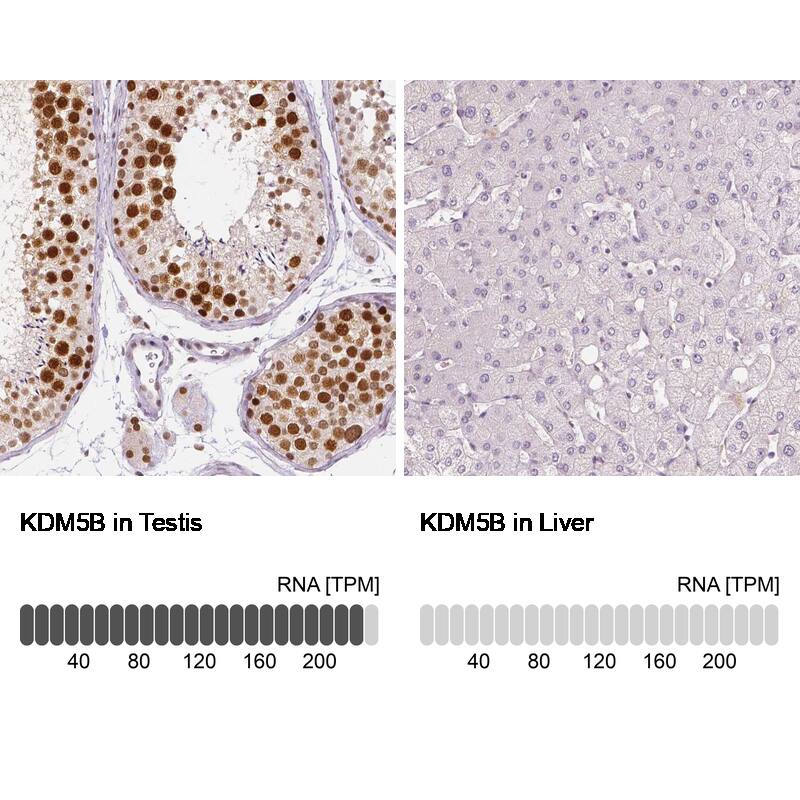 Lysine (K)-specific Demethylase 5B/KDM5B/JARID1B Antibody (CL1129) - Azide and BSA Free Immunohistochemistry-Paraffin: Lysine (K)-specific Demethylase 5B/KDM5B/JARID1B Antibody [NBP3-43901]