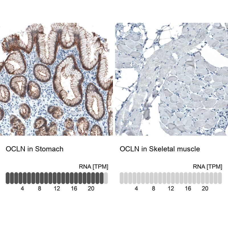 Occludin Antibody (CL1555) - Azide and BSA Free Immunohistochemistry-Paraffin: Occludin Antibody [NBP3-43902]