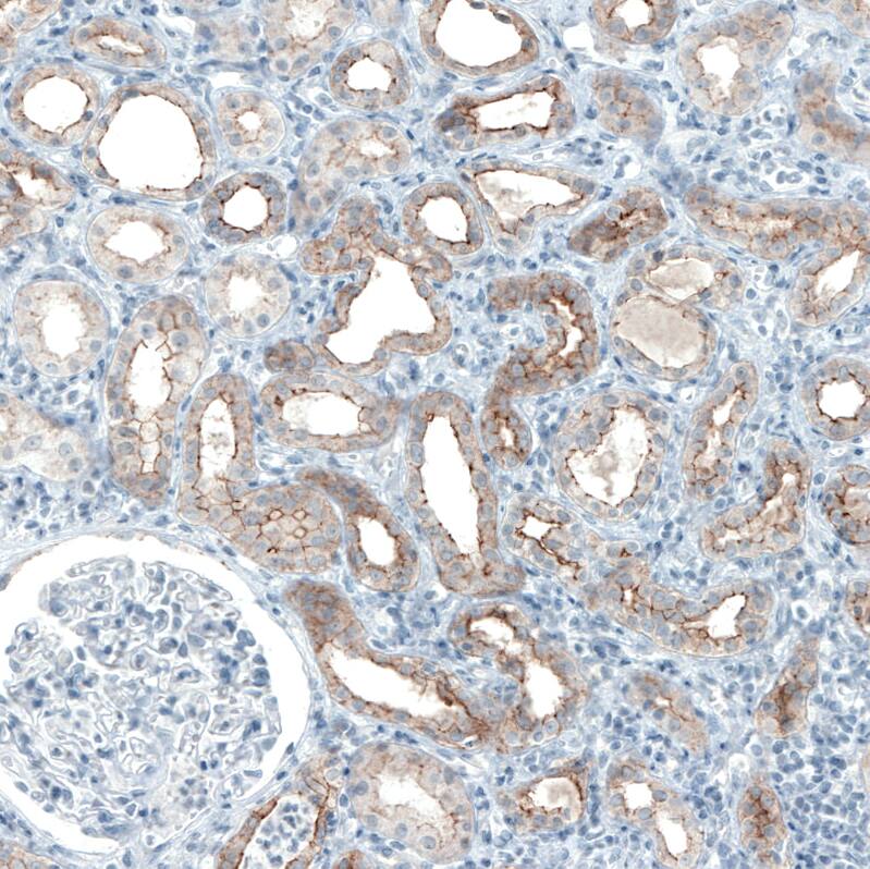Occludin Antibody (CL1555) - Azide and BSA Free Immunohistochemistry-Paraffin: Occludin Antibody [NBP3-43902]
