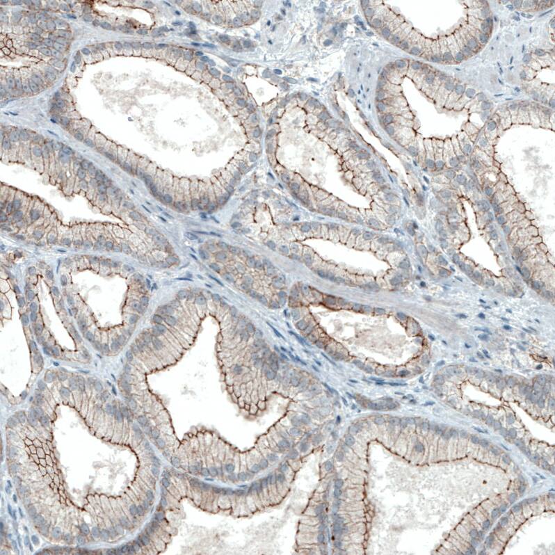 Occludin Antibody (CL1555) - Azide and BSA Free Immunohistochemistry-Paraffin: Occludin Antibody [NBP3-43902]