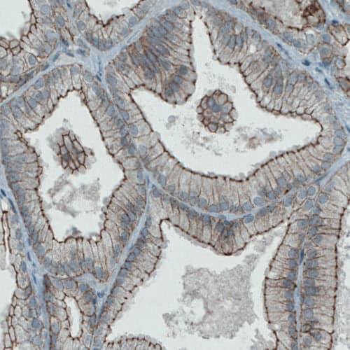 Occludin Antibody (CL1608) - Azide and BSA Free Immunohistochemistry-Paraffin: Occludin Antibody [NBP3-43904]