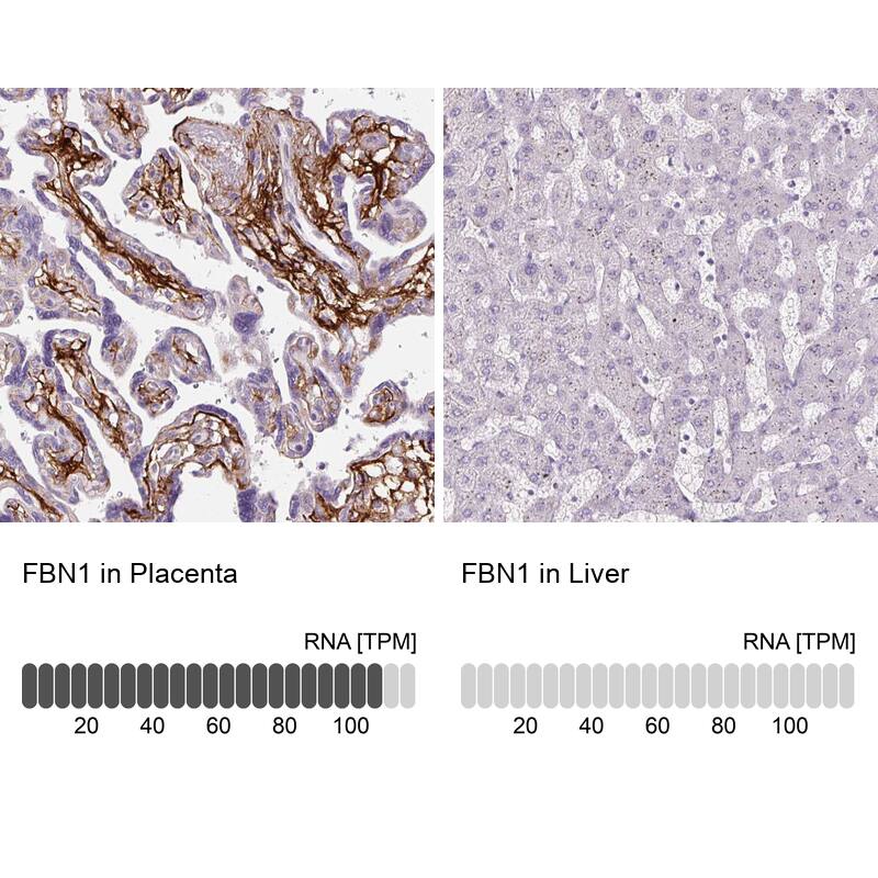 Fibrillin 1 Antibody (CL0225) - Azide and BSA Free Immunohistochemistry-Paraffin: Fibrillin 1 Antibody [NBP3-43905]