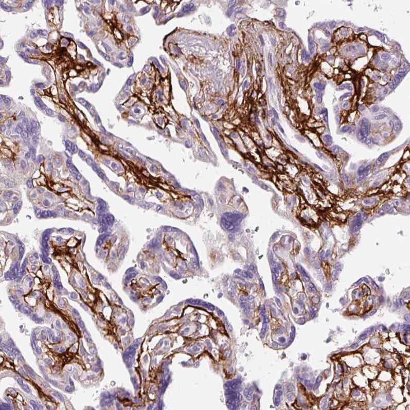 Fibrillin 1 Antibody (CL0225) - Azide and BSA Free Immunohistochemistry-Paraffin: Fibrillin 1 Antibody [NBP3-43905]