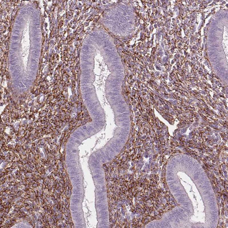 Fibrillin 1 Antibody (CL0226) - Azide and BSA Free Immunohistochemistry-Paraffin: Fibrillin 1 Antibody [NBP3-43906]