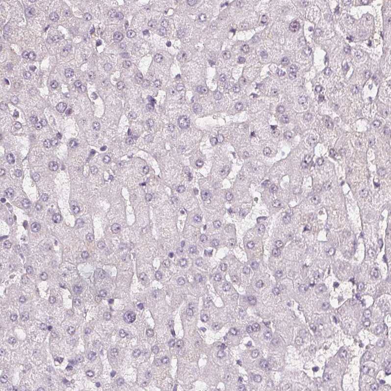 Fibrillin 1 Antibody (CL0226) - Azide and BSA Free Immunohistochemistry-Paraffin: Fibrillin 1 Antibody [NBP3-43906]