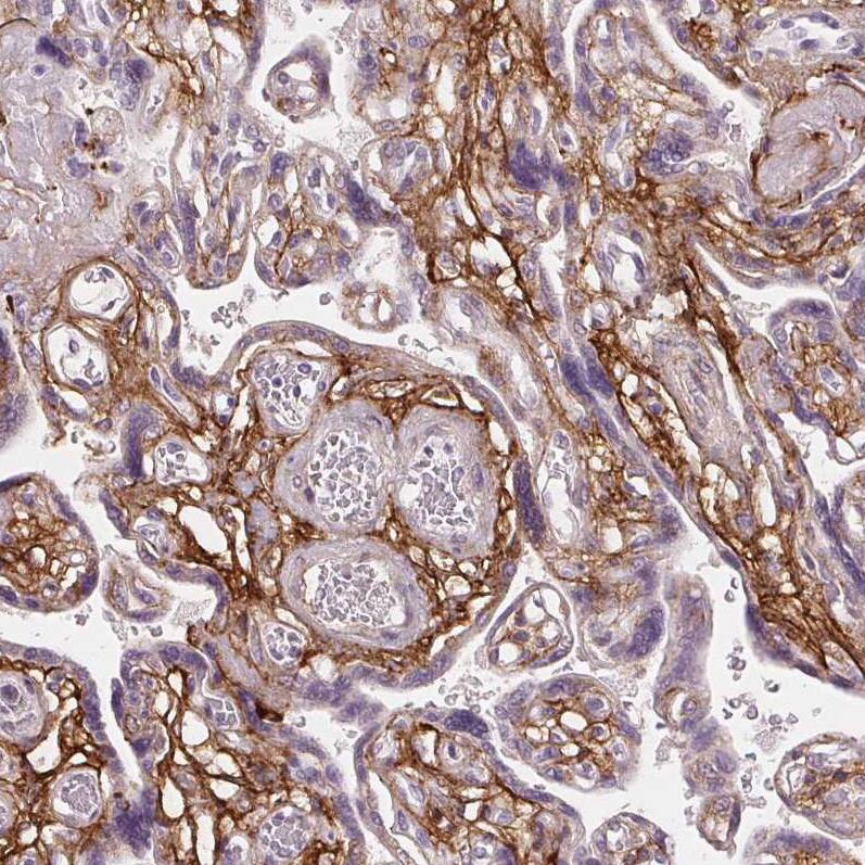 Fibrillin 1 Antibody (CL0226) - Azide and BSA Free Immunohistochemistry-Paraffin: Fibrillin 1 Antibody [NBP3-43906]