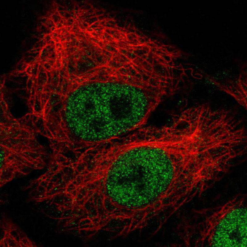 ZEB1 Antibody (CL0151) - Azide and BSA Free Immunocytochemistry/ Immunofluorescence: ZEB1 Antibody [NBP3-43907]